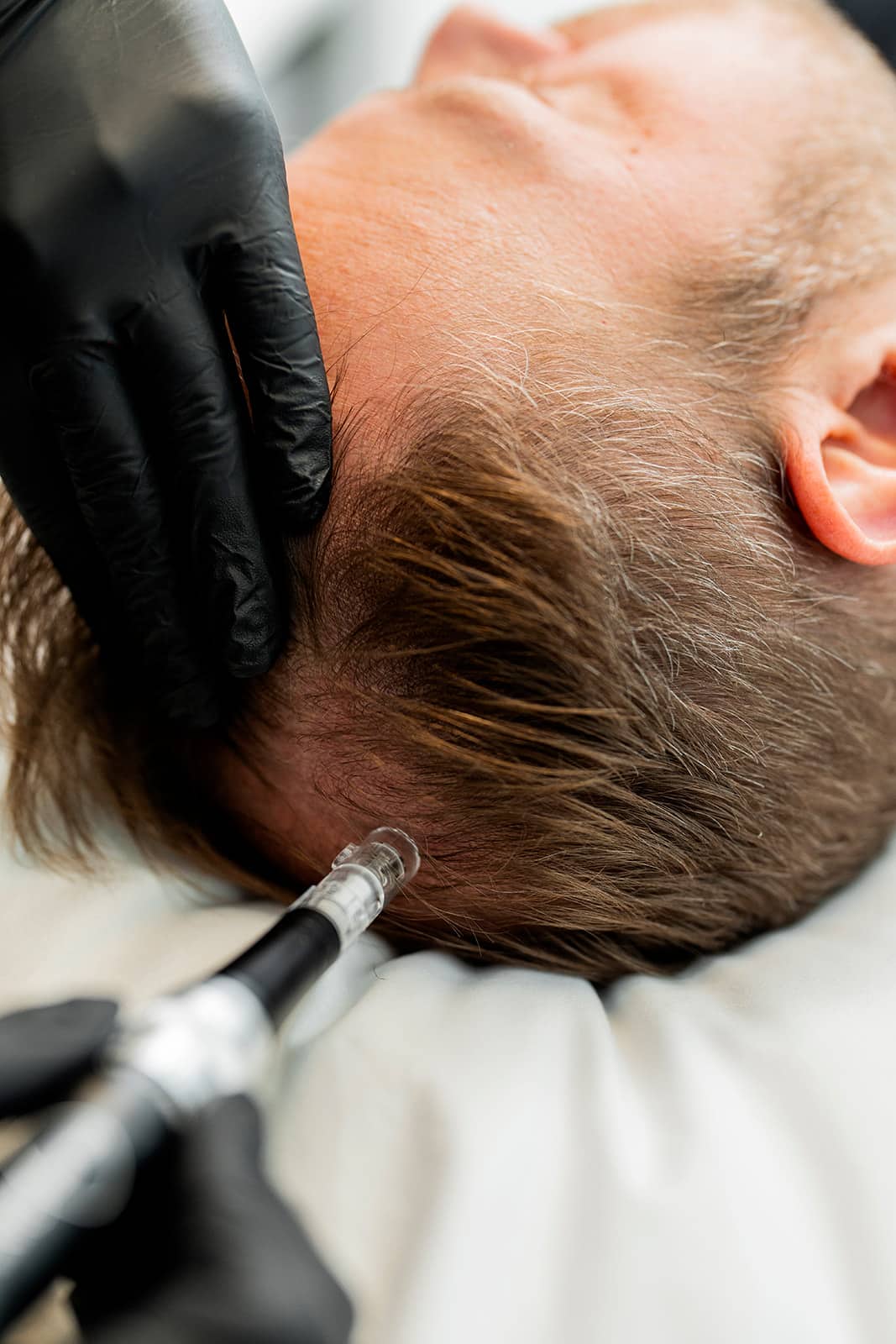 DE|RIVE Hair Restoration